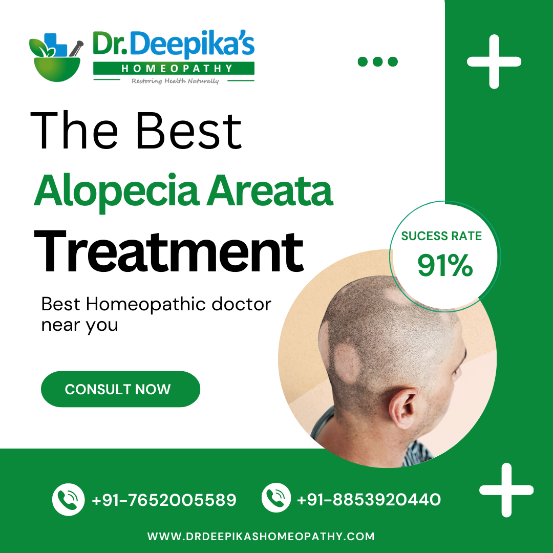 Get Affordable and Best Alopecia Areata Treatment