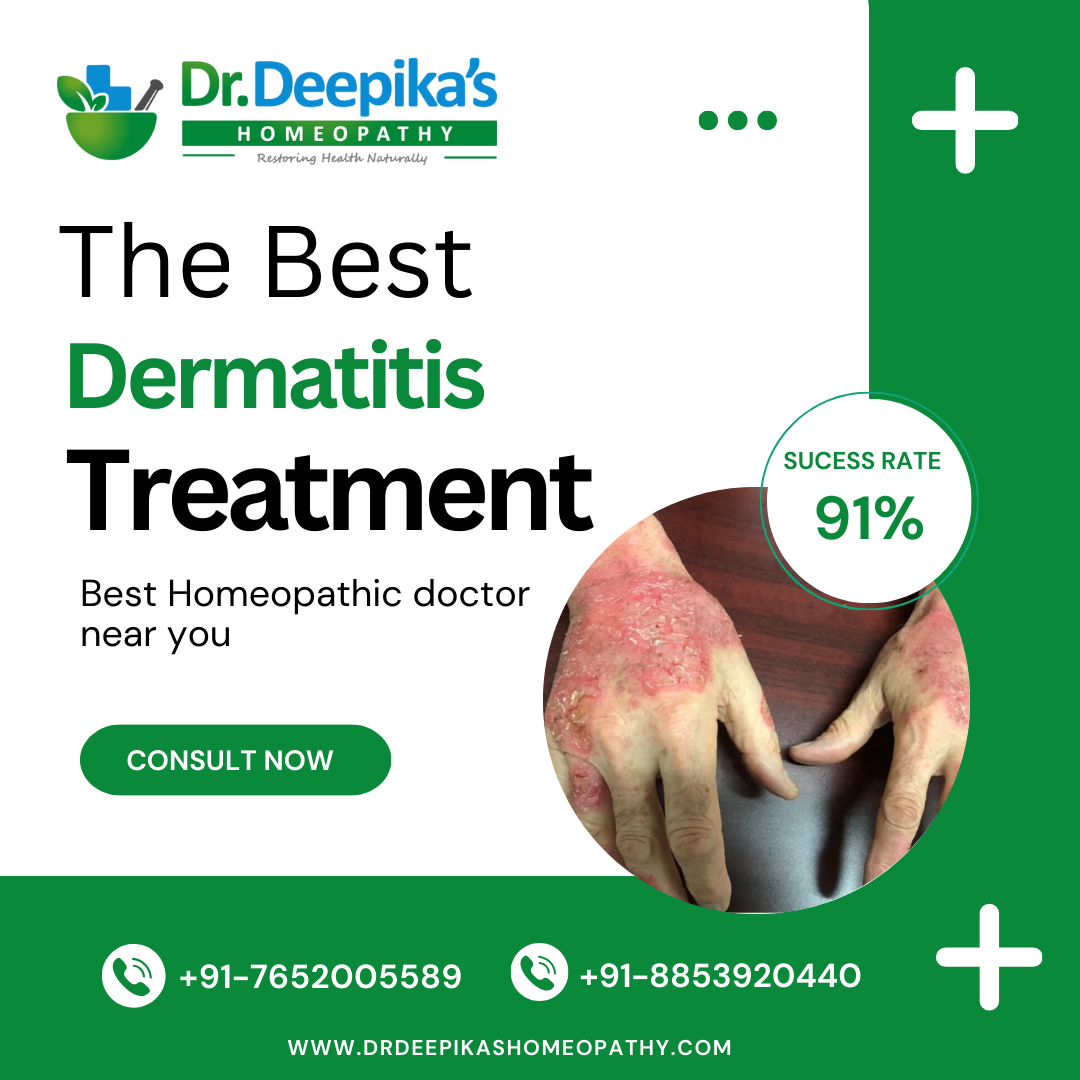 Get Affordable and Best Dermatitis treatment