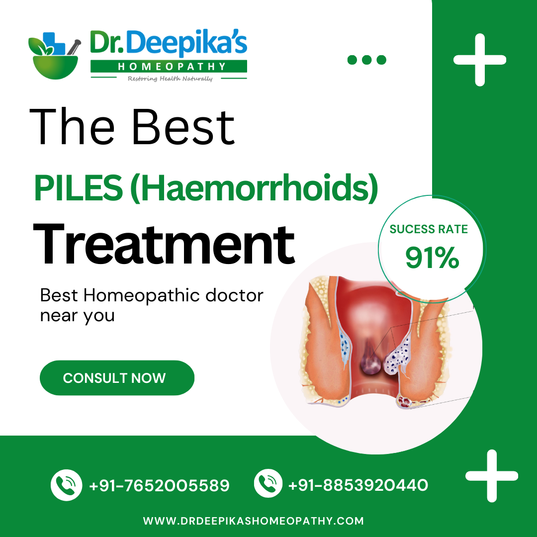 Get Affordable and Best Piles Treatment