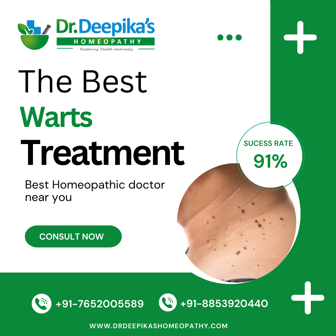 Get Affordable and Best Warts Treatment