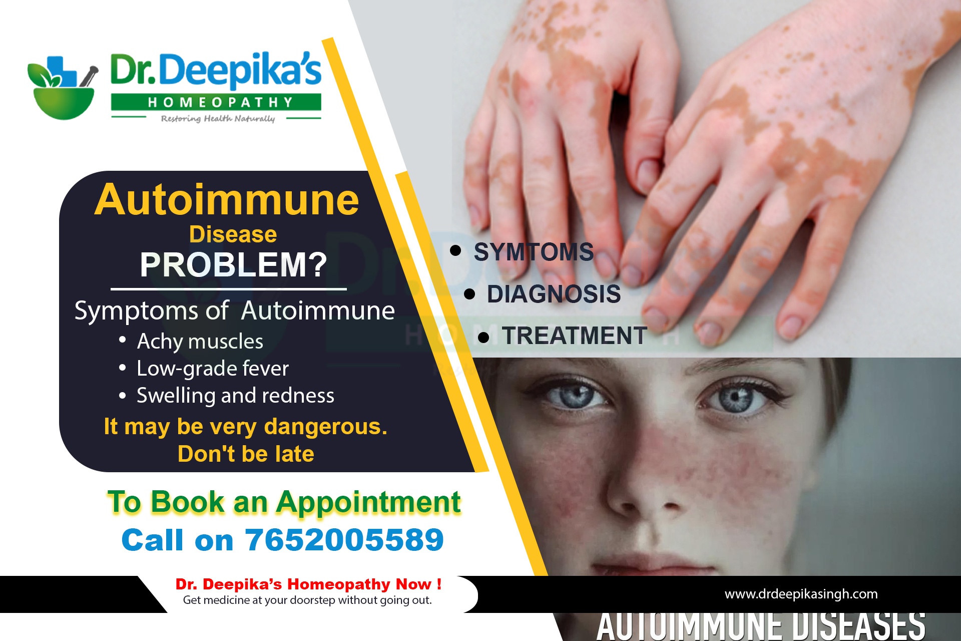 What is autoimmune disease? & How it can cure naturally using homeopathy?