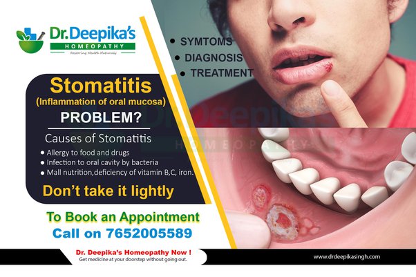 What is Stomatitis or “Inflammation of oral mucosa” disease? & How it can cure naturally using homeopathy?
