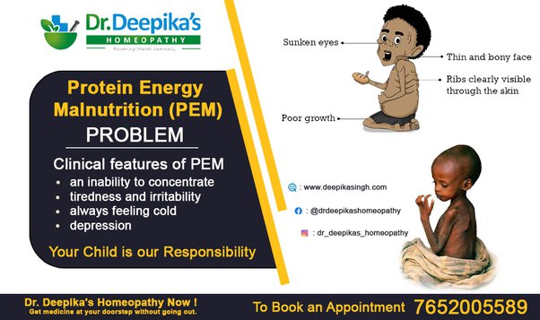 What is Protein Energy Malnutrition (PEM) & How it can cure naturally using homeopathy?