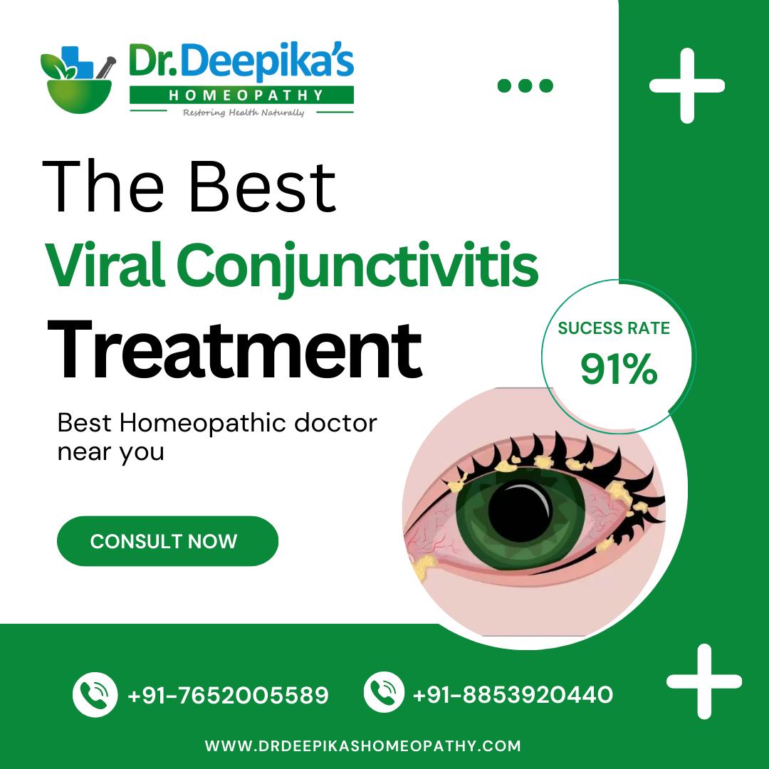 Get Affordable and Best Viral Conjunctivitis Treatment