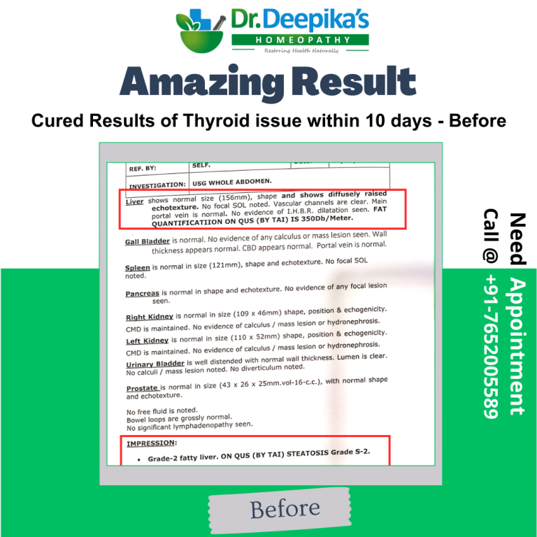 Cured Results of Fatty Liver issue from Grade 2 to Grade 1 of Mr. Nitin at Dr. Deepika's Homeopathy-Before