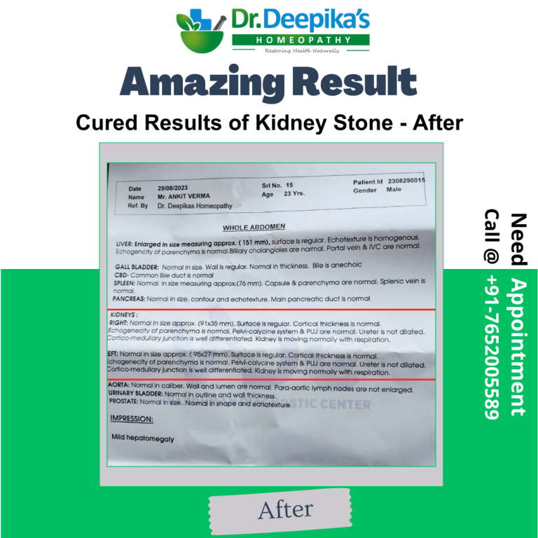 Cured Results of Kidney Stone of Mr. Ankit at Dr. Deepika's Homeopathy After