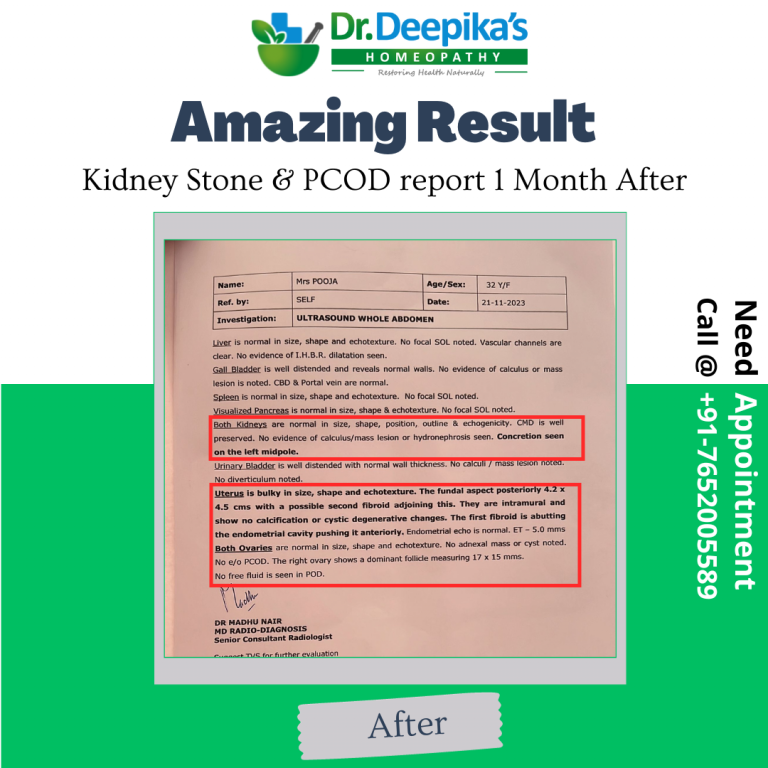 Cured Results of PCOD And Kidney Stone of Miss Pooja at Dr. Deepika's Homeopathy