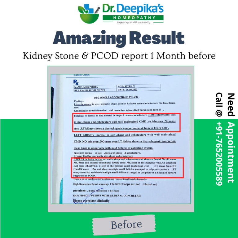 Cured Results of PCOD And Kidney Stone of Miss Pooja at Dr. Deepika's Homeopathy Before