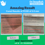 Overcoming PCOD and Hormonal Imbalance: A Success Story at Dr. Deepika's Homeopathy | Cured Results of PCOD of 2-5 mm of Miss Vanshika at Dr. Deepika's Homeopathy