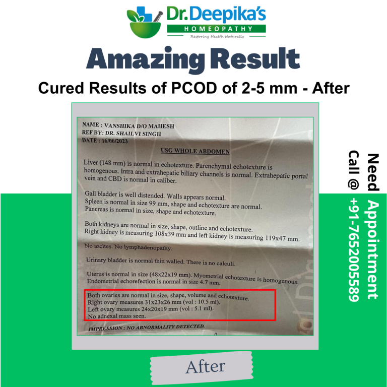 Overcoming PCOD and Hormonal Imbalance: A Success Story at Dr. Deepika's Homeopathy | Cured Results of PCOD of 2-5 mm of Miss Vanshika at Dr. Deepika's Homeopathy