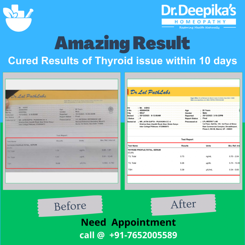 Best Thyroid Treatment in Noida: Mr. Anshu’s Remarkable Recovery Journey of Thyroid at Dr. Deepika’s Homeopathy