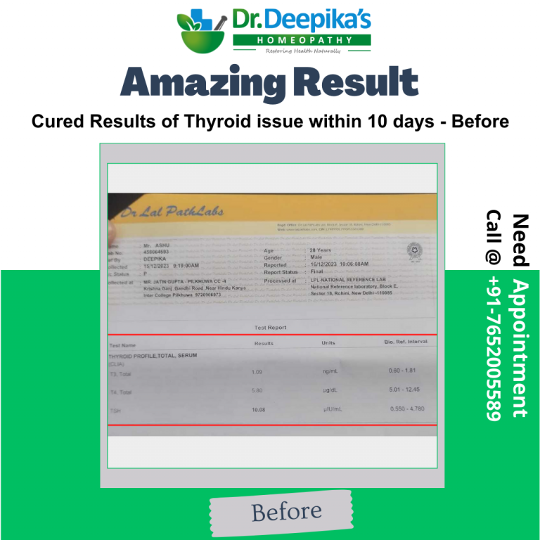 Mr. Anshu's Remarkable Recovery Journey of Thyroid at Dr. Deepika's Homeopathy: Best Thyroid Treatment in Noida : Before Report