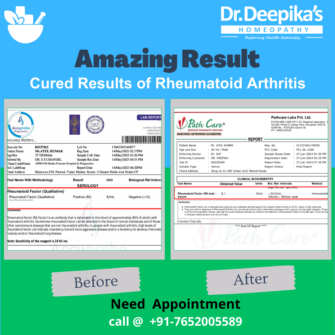 Revitalizing Lives: Triumph Over Rheumatoid Arthritis at Dr. Deepika’s Homeopathy